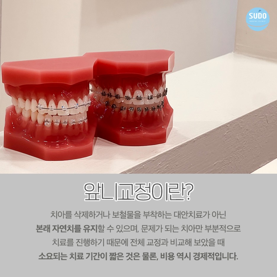 수도치과 치아교정
