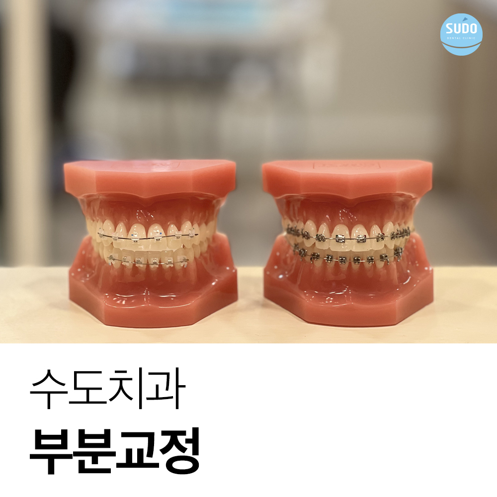 영도치아교정